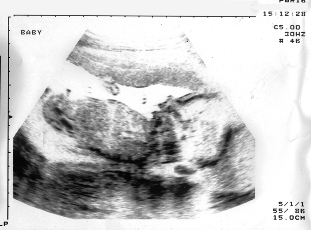 Page 1 Image 3