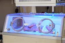 Jaundice in newborns
